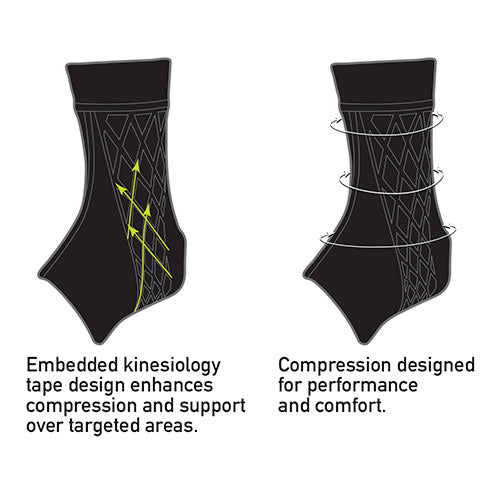 IMAK Spark Kinetic Ankle Sleeve