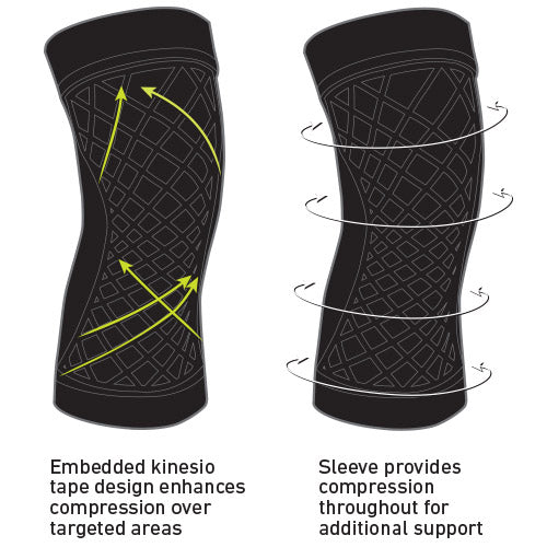 IMAK Spark Kinetic Knee Sleeve